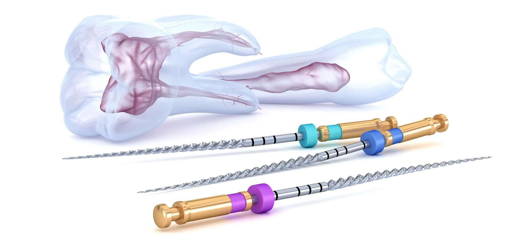 Dévitalisation - traitement endodontique - Dentiste Septeuil 78790