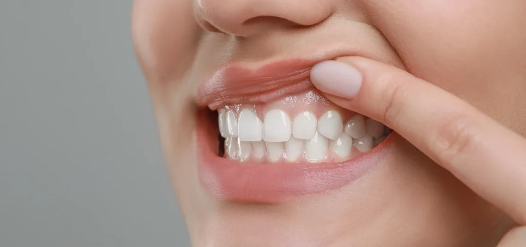 Soin de gencives à Septeuil